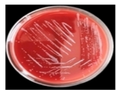 환자의 혈액에서 분리한 Pantoea agglomerans.