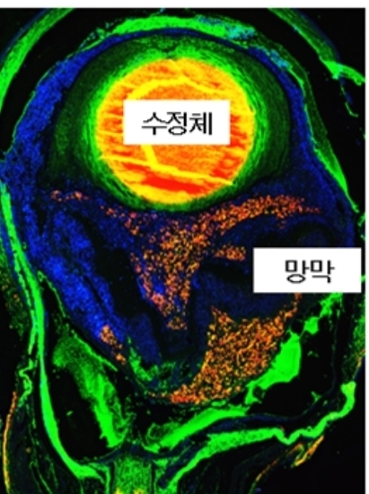 면역형광분석을 통한 안구내 주사 교묘세포종 동물모델 확인