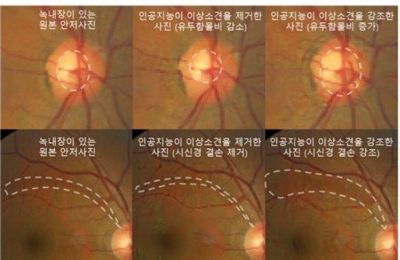 원본 안저사진(왼쪽)과 적대적 설명 방법론을 적용해 생성된 안저사진(가운데, 오른쪽)