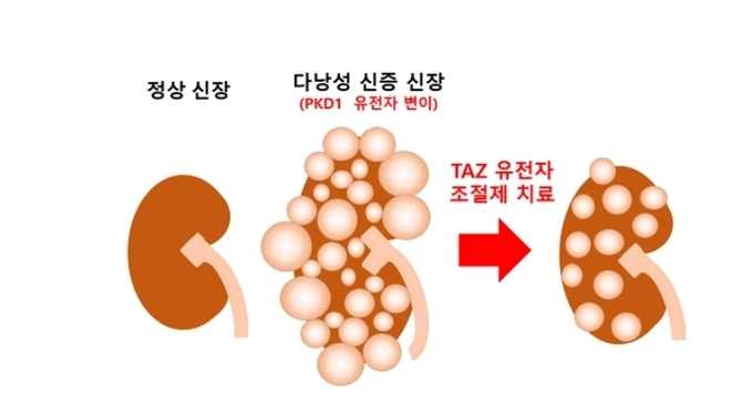 상염색체 우성 다낭성 신증의 TAZ 유전자 조절 치료