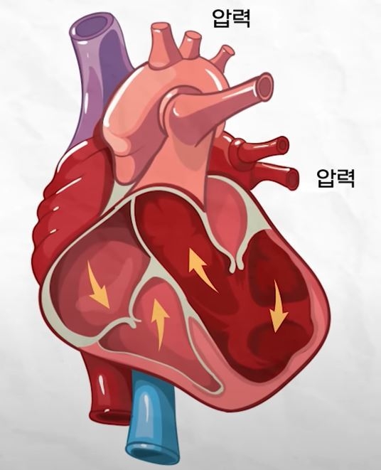 혈압의 정의
