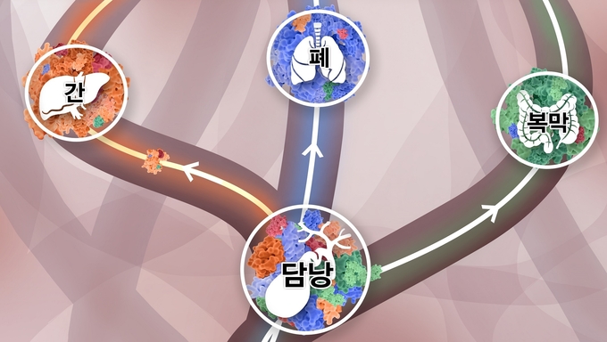 담낭에 다양한 클론들이 섞여 있다가, 주황색 클론이 이긴 암세포는 간으로, 파란색 클론이 이긴 암세포는 폐로, 초록색 클론이 이긴 암세포는 복막으로 간다.