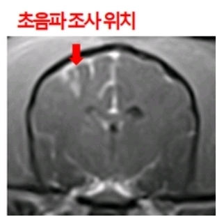 케이메디허브는 2월 집속초음파 뇌질환 치료기술의 대동물 비임상 연구를 개시하였다. 집속초음파 조사 장치, 뇌 자기공명영상 기반 내비게이션 시스템을 대동물에 적용하는 비임상 연구 모습(좌), 초음파에 의한 안전하고 안정적인 혈뇌장벽 개통을 확인한 자기공명영상(우)