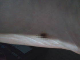 주사기, 생산 늘었는데 현장은 여전히 부족?…유통 불균형, 매점매석 없나 살핀다