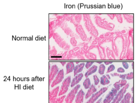 조직 내 철분 농도 높을수록 "FLASH 치료의 정상조직 보호 떨어져"...방사선치료의 정상조직 보호 원리 규명