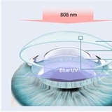 원추각막 환자,통증과 감염 부담 적고 치료 시간 단축...시력 교정용 콘택트 렌즈 개발