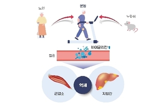 운동,나이 들수록 '선택 아닌 필수'...노화로 인한 근감소증·지방간 동시 개선