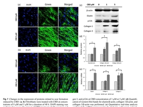 환각 없는 대마 'CBD', 여드름 치료 '게임 체인저' 되나