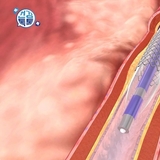 “명절 가슴 통증, 넘기지 마세요”…겨울철 심근경색 ‘골든타임’ 사수해야