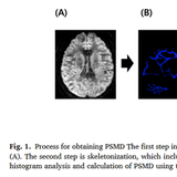 “살이 조금만 쪄도 뇌에 변화 시작”… 과체중 단계부터 뇌 미세혈관 손상 확인