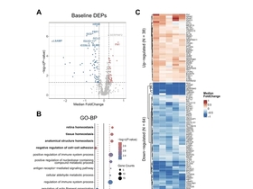 소아 조혈모세포이식 간정맥폐쇄성질환, AI로 조기 선별