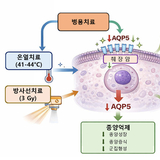 해운대백병원, 췌장암 온열치료 병행 시 방사선치료 효과 증가