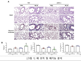 “폐섬유화 악화 막는 핵심 스위치 찾았다”…ATF3 유전자 역할 규명