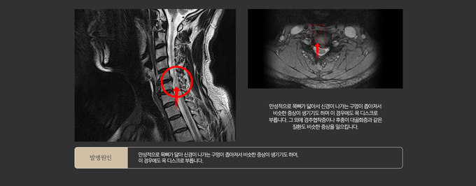 손이 저려서 병원을 찾았는데 ‘목 디스크’라니...